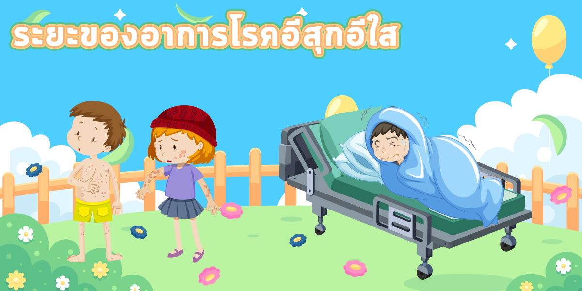 ระยะของอาการโรคอีสุกอีใส